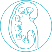 Kidney cancer