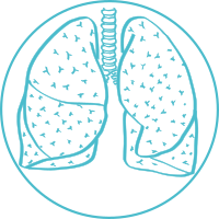 Lung cancer