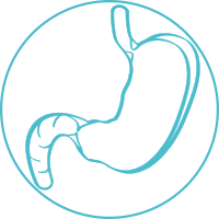 Stomach cancer